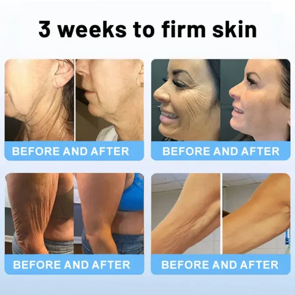 🍁✨Furzero® Oligopeptide-Infused Skin Firming Cream
