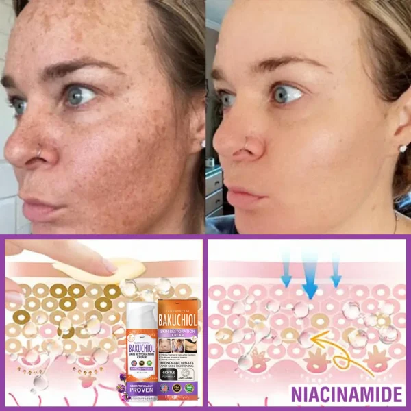 🇺🇸🌺Made in an FDA-Registered Facility: 𝐅𝐮𝐫𝐳𝐞𝐫𝐨® 𝐐𝐮𝐞𝐞𝐧 𝐍𝐞𝐜𝐭𝐚𝐫 𝐏𝐞𝐩𝐭𝐢𝐝𝐞 + 𝐁𝐚𝐤𝐮𝐜𝐡𝐢𝐨𝐥 𝐒𝐤𝐢𝐧 𝐑𝐞𝐬𝐭𝐨𝐫𝐚𝐭𝐢𝐨𝐧 𝐂𝐫𝐞𝐚𝐦 - 𝐀𝐧𝐭𝐢-𝐚𝐠𝐢𝐧𝐠, 𝐇𝐲𝐝𝐫𝐚𝐭𝐢𝐧𝐠, 𝐒𝐤𝐢𝐧 𝐅𝐢𝐫𝐦𝐢𝐧𝐠 & 𝐋𝐢𝐟𝐭𝐢𝐧𝐠, 𝐒𝐤𝐢𝐧 𝐑𝐞𝐩𝐚𝐢𝐫, 𝐄𝐯𝐞𝐧 𝐓𝐨𝐧𝐞
