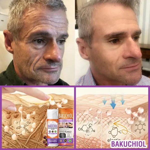 🇺🇸🌺Made in an FDA-Registered Facility: 𝐅𝐮𝐫𝐳𝐞𝐫𝐨® 𝐐𝐮𝐞𝐞𝐧 𝐍𝐞𝐜𝐭𝐚𝐫 𝐏𝐞𝐩𝐭𝐢𝐝𝐞 + 𝐁𝐚𝐤𝐮𝐜𝐡𝐢𝐨𝐥 𝐒𝐤𝐢𝐧 𝐑𝐞𝐬𝐭𝐨𝐫𝐚𝐭𝐢𝐨𝐧 𝐂𝐫𝐞𝐚𝐦 - 𝐀𝐧𝐭𝐢-𝐚𝐠𝐢𝐧𝐠, 𝐇𝐲𝐝𝐫𝐚𝐭𝐢𝐧𝐠, 𝐒𝐤𝐢𝐧 𝐅𝐢𝐫𝐦𝐢𝐧𝐠 & 𝐋𝐢𝐟𝐭𝐢𝐧𝐠, 𝐒𝐤𝐢𝐧 𝐑𝐞𝐩𝐚𝐢𝐫, 𝐄𝐯𝐞𝐧 𝐓𝐨𝐧𝐞