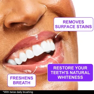 Furzero® Colour Corrector Serum – 🧑⚕️ FDA Certified Enamel-Safe Teeth Whitening & Stain Removal for Sensitive Teeth💜💜