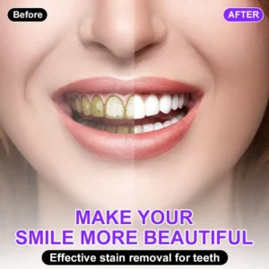 Furzero® Colour Corrector Serum – 🧑⚕️ FDA Certified Enamel-Safe Teeth Whitening & Stain Removal for Sensitive Teeth💜💜