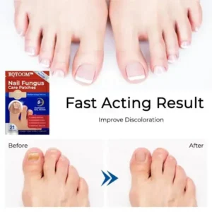 BQYOOM™ Nail Fungus Care Patches