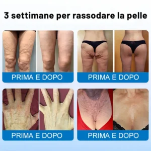 🍁✨Furzero® Oligopeptide-Infused Skin Firming Cream