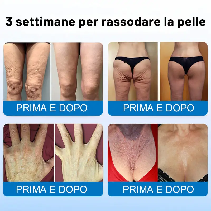 🍁✨Furzero® Oligopeptide-Infused Skin Firming Cream