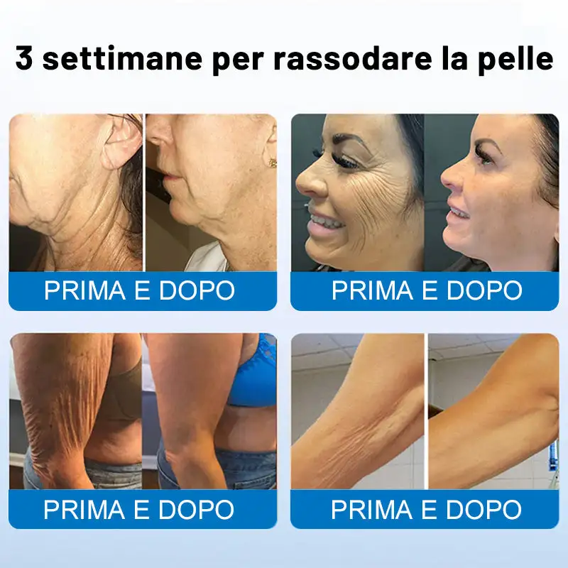 🍁✨Furzero® Oligopeptide-Infused Skin Firming Cream