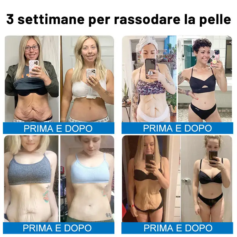 🍁✨Furzero® Oligopeptide-Infused Skin Firming Cream